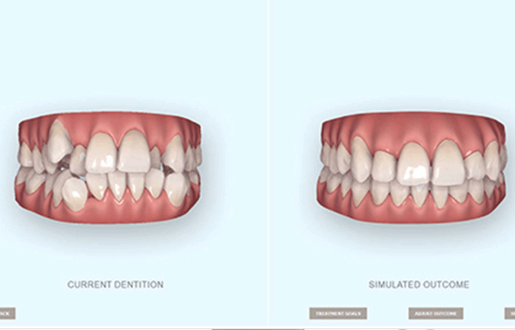 画像のタイトル
