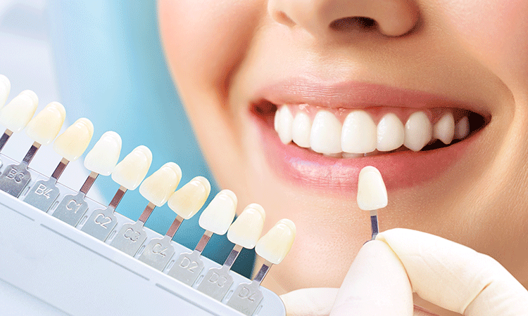 セラミック治療