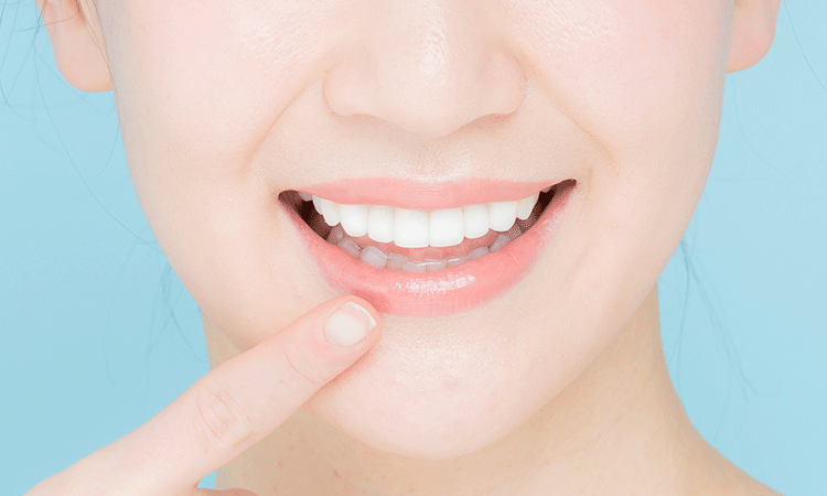 ホワイトニング