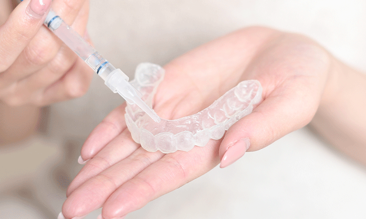 ホームホワイトニング