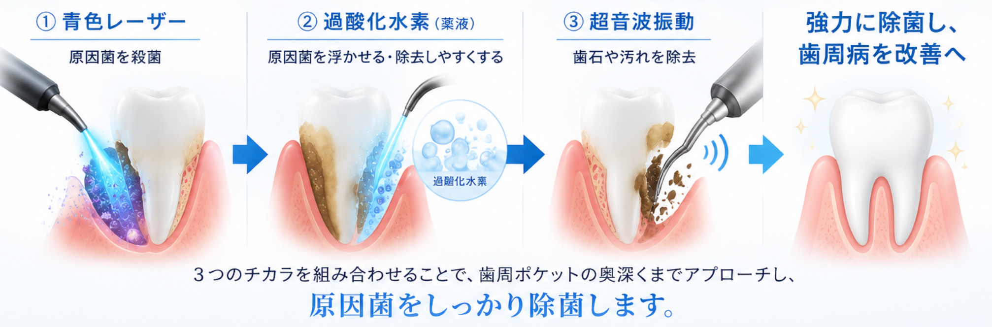 ブルーラジカルとは