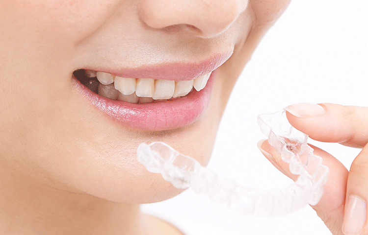 矯正治療：全額矯正