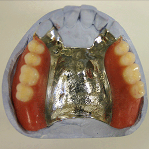 コバルトクロム