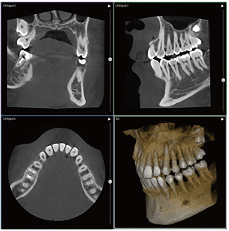 精密な検査と診断