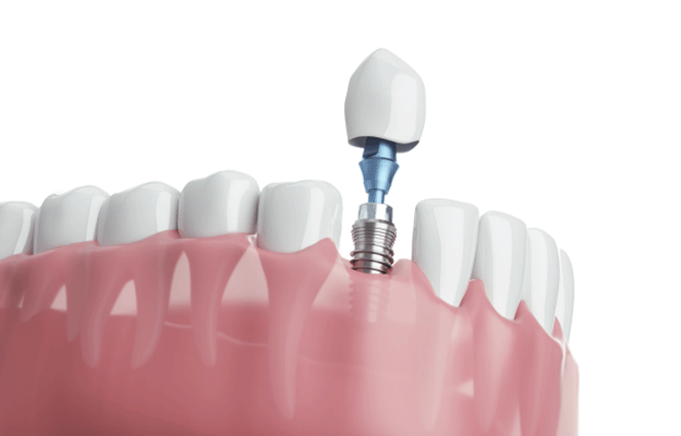 治療期間の目安