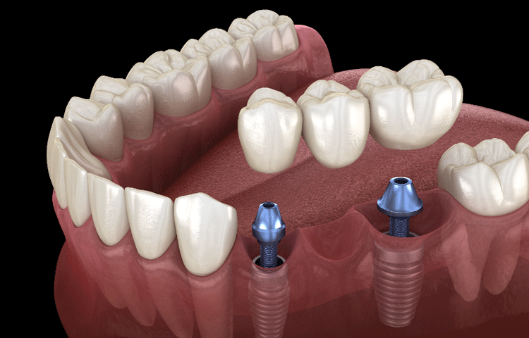 治療期間の目安