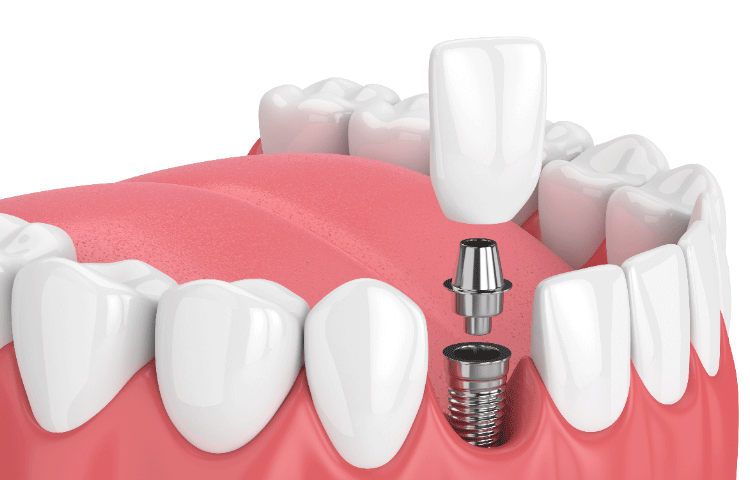 カウンセリング