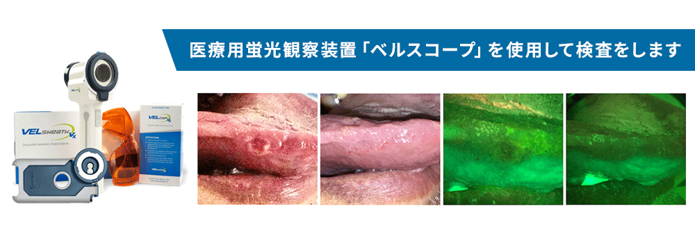 当院で行う口腔がん検診について