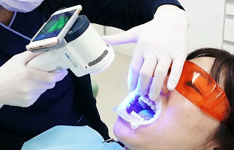 当院で行う口腔がん検診について