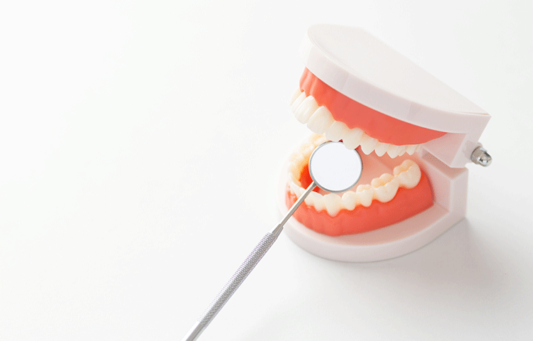 歯周病の症状は