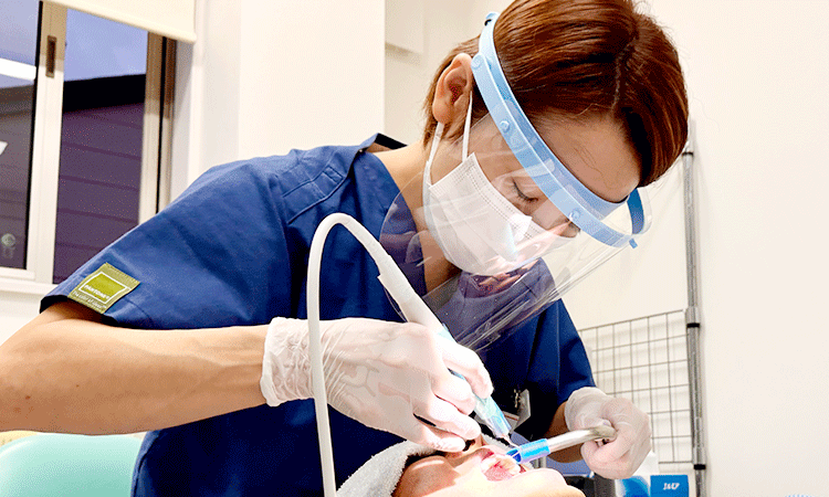 歯石除去・クリーニング