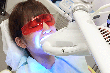 ホームホワイトニング