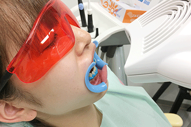 ホームホワイトニング